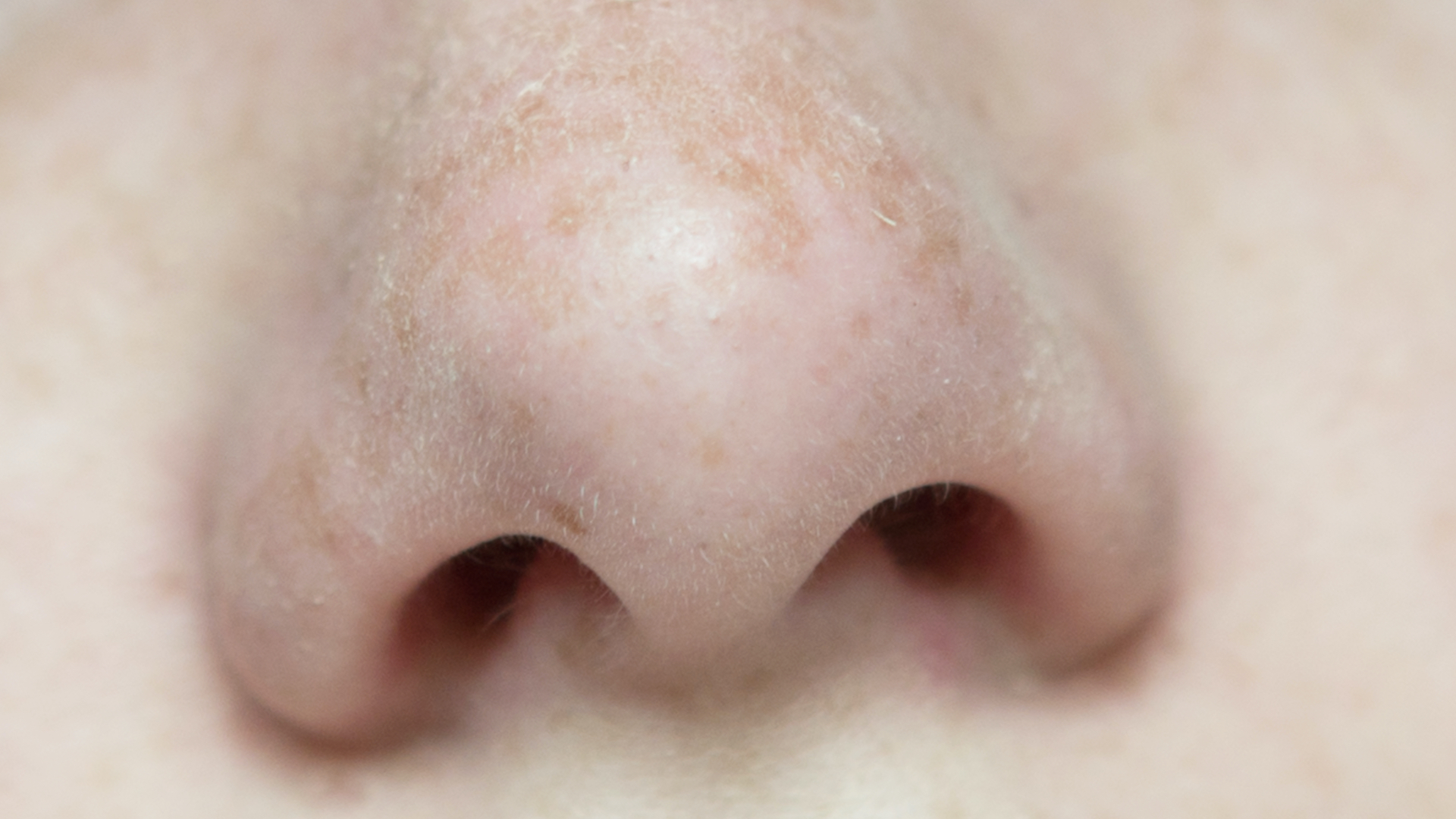 A nose